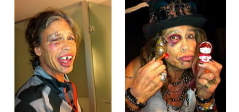 Steven Tyler injuries