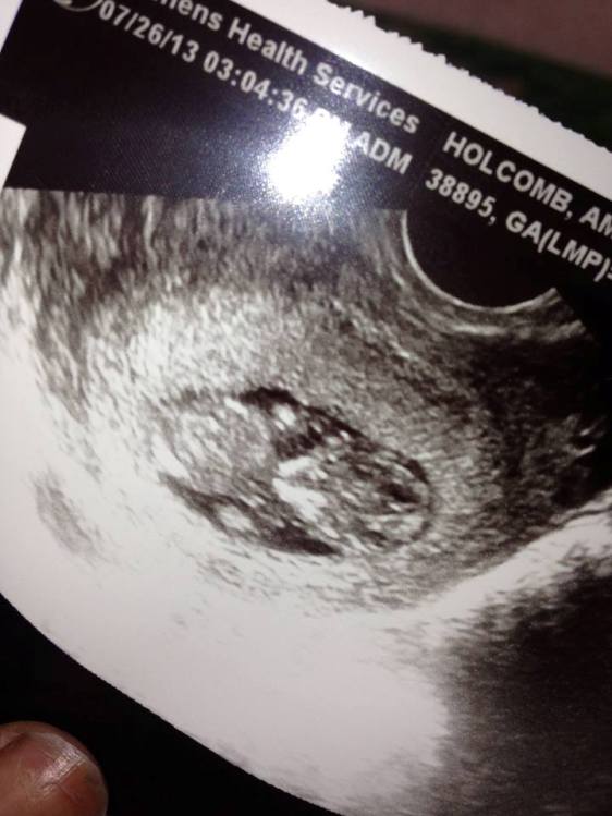 amber-holcomb-pregnant-baby-ultrasound